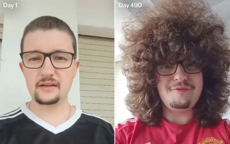 493 days and counting: The Man United fan trapped by his own hair vow